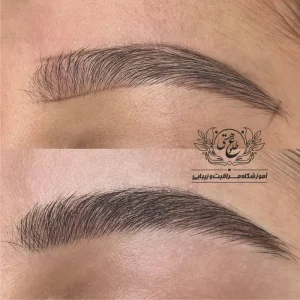 میکروبلیدینگ در مشهد